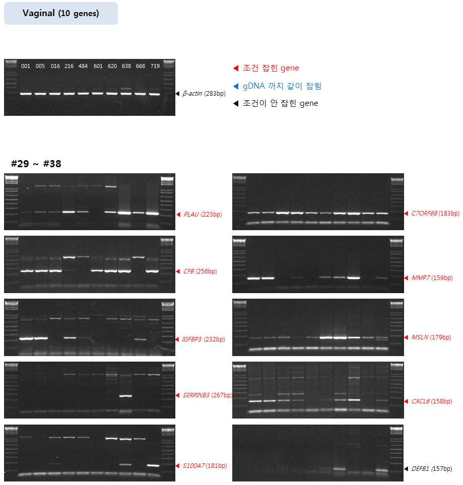 질 분비액 특이적 마커유전자의 발현을 측정하기 위한 primer test