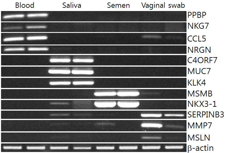 RT-PCR을 이용한 체액 대표 마커 유전자의 검증 (좋은 예).