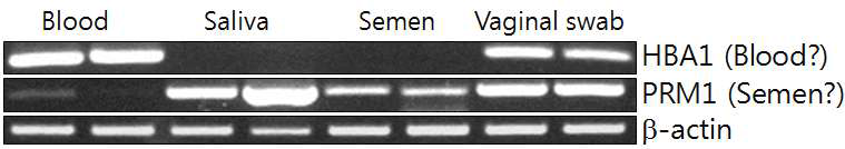 기존의 알려진 체액 특이적 mRNA 마커인 HBA1과 PRM1의 체액 특이적이지 않은 발현 패턴