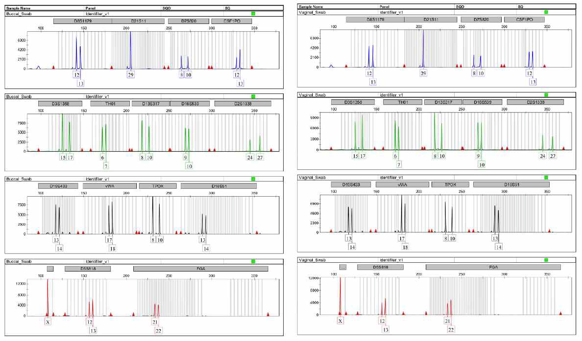 침과 질 분비액 샘플에서 RNA와 동시 추출된 DNA로부터 얻어진 STR profile 분석 결과