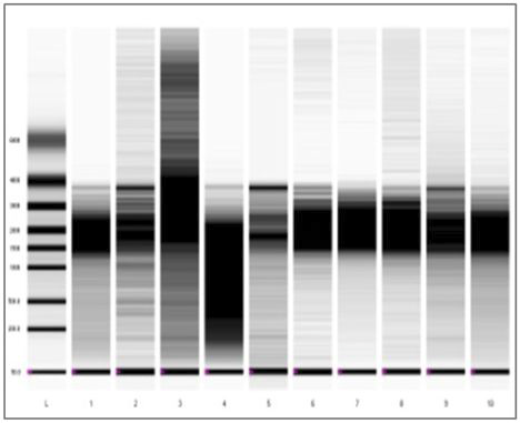 범죄현장 RNA 시료 상태의 예