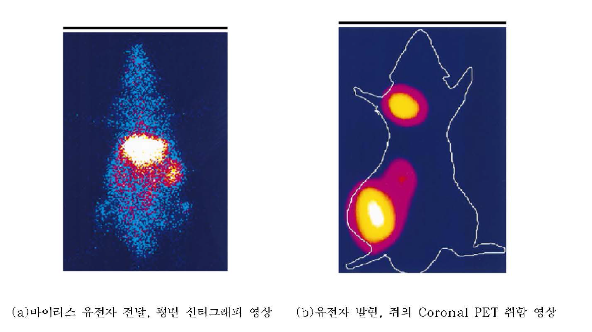 정밀의료기기의 외국개발 사례