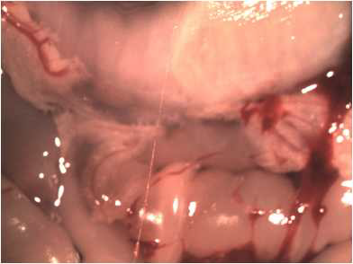 간에서 출혈을 유발한 후 세척 하여 얻은 Fibrine - 장기표면봉한관의 반투명한 형태와 유사한모습을 보인다.