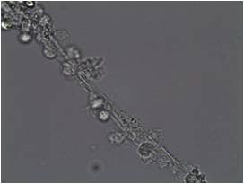 봉한관 무염색 도말표본의 광학 현미경 관찰 - 소관다발구조가 선명하 게 관찰된다.