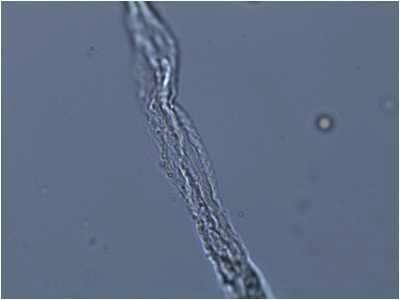 분리된 위비인대 도말표본의 광학현미경 관찰 - 소관다발구조와 유 사한 형태가 관찰된다.