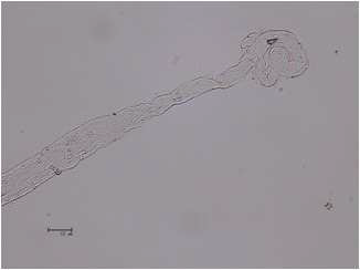 분리된 장간막 도말표본의 광 학 현미경 관찰 - 불규칙한 무늬가 관 찰된다.