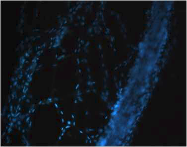 장간막 분리조직(위비인대)의 DAPI 형광염색 사진 - 섬유가닥이 분 리되어 흩어져있다.