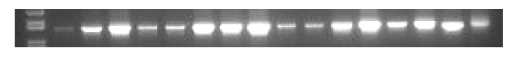 16S rDNA의 PCR 증폭 산물.