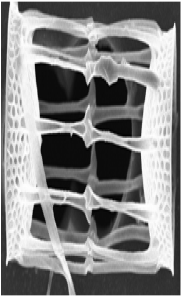 Skeletonema cf. marinoi