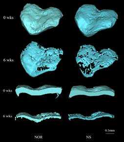 The growth plates were extracted from the tibiae and 3D images were reconstructed, and the volume of the growth-plate (GV, mm³) and thickness I, II of the growth-plate (Gp.Th I, II) were measured.