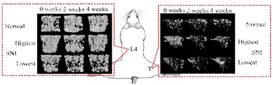 Longitudinal changes in the 3D microarchitecture of trabecular bone; NOR: intact sciatic nerve, SNI: sciatic nerve injury, L4: the fourth lumbar vertebra, T: tibia.