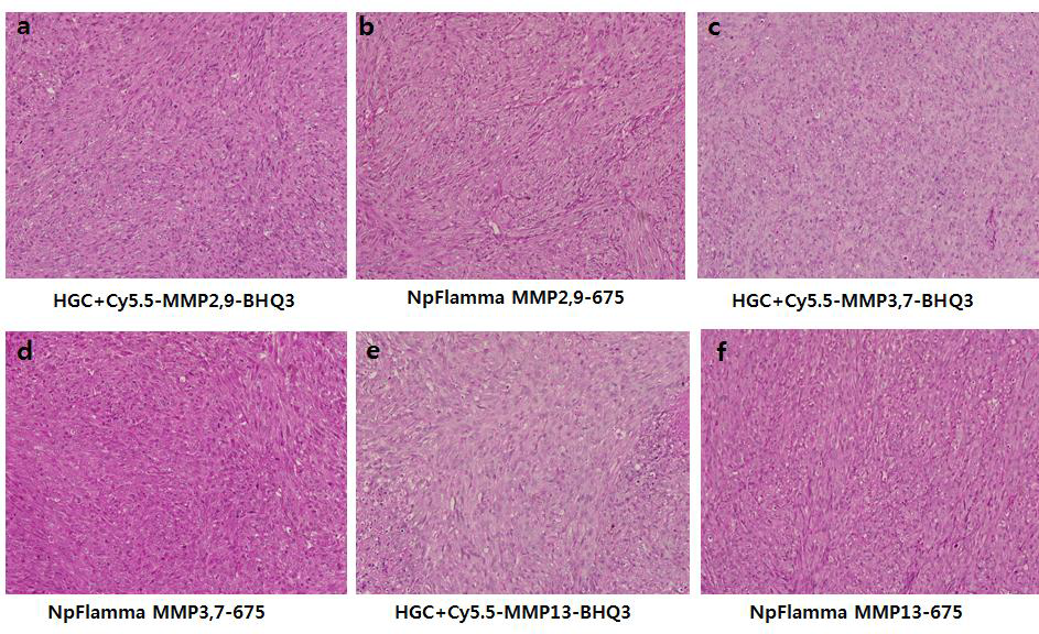 단백질 분해효소 특이 분해 나노입자별 7일 생체 내 거동 후 종양의 H&E 염색.
