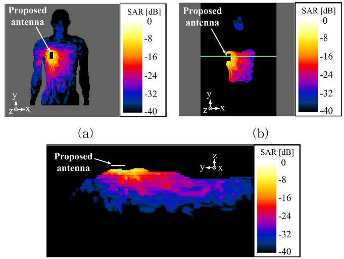 Duke 인체 모델을 이용한 제안된 안테나의 평균 SAR 분포