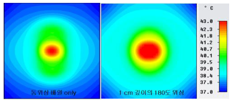 중심소자의 위상에 따른 5 cm 깊이에서의 온도 분포