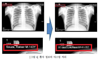 의료 이미지 데이터 비식별화 처리 예시