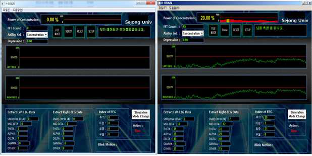 뇌전도 분석 시뮬레이터