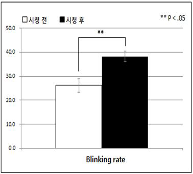 시각기능(blinking rate) 분석 결과