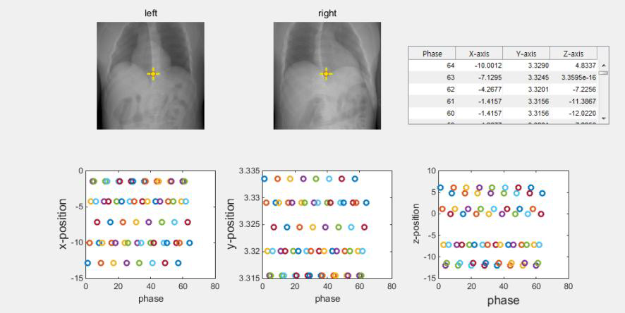 real-time tumour tracking applying tracking algorithm using the simulator