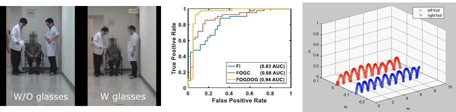 파킨슨병 환자 보행 보조 소프트웨어 개발 및 걸음걸이 3차원 정보 분석 결과
