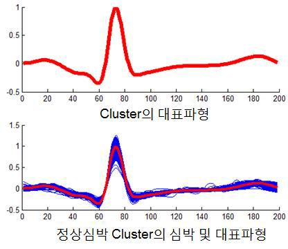 제안한 심전도 구간 결정에 따른 Cluster 결과