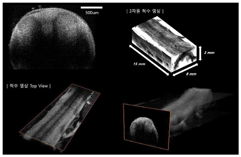 근적외선 광간섭 기반 고해상도 영상 시스템으로 촬영한 마우스 척수의 2차원 및 3차원 영상.