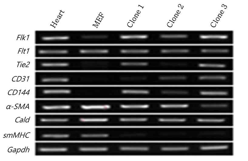 체세포에서 유도된 혈관내피세포의 각 클론(clone1,2,3)의 혈관내피세포 특이적 유전자 발현을 RT-PCR을 통하여 확인.