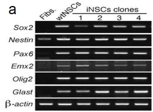 체세포에서 유도된 신경줄기세포의 각 클론 (clone1,2,3,4)의 신경줄기세포 특이적 유전자 발현을 RT-PCR을 통하여 확인.