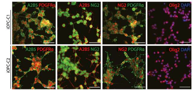 제작된 희소돌기아교전구세포의 특이적 마커를 (A2B5/PDGFα/NG2/Olig2)로 염색하여, 제작된 희소돌기아교전구세포의 특성을 확인함.