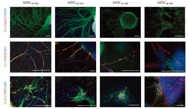 다양한 만능유도줄기세포에서의 신경세포 분화.