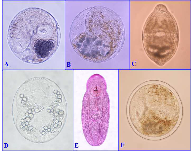 Metacercariae of zoonotic fishborne trematode detected in the present study. A. Clonorchis sinensis; B. Metagonimus sp.; C. Centrocestus armatus; D. Echinostoma sp.; E. Clinostomum complanatum; F. Metorchis orientalis.