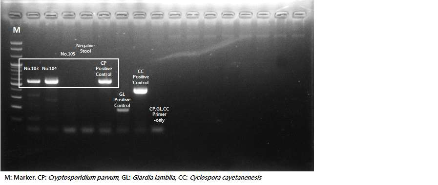 Multiplex PCR 103번, 104번 agarose gel 전기영동 결과