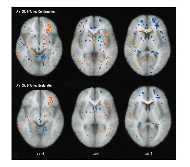 공격행동 통제와 관련된 뇌영역: 전측대상회와 내측후방안와피질의 활성화
