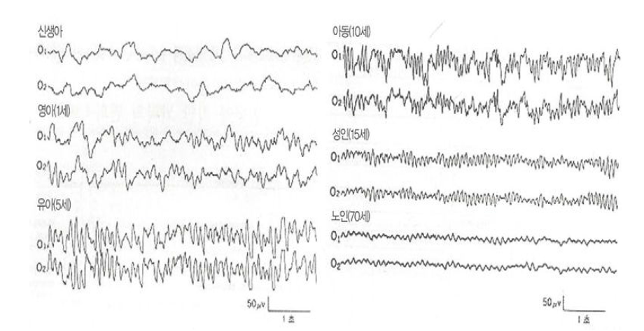 성장에 따른 뇌파의 변화
