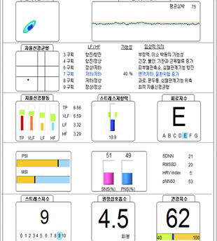 소음에 노출되었을 때 스트레스 지수