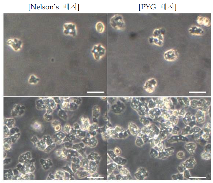 Nelso's배지(왼쪽)및 PYG배지(오른쪽)에서 배양되고 있는 자유생활아메바 한국분리주