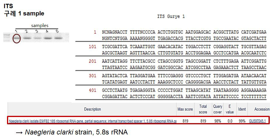 구례지역 수계에서 ITSprimer을 이용한 PCR법으로 확인된 5.8S-rRNA 염기서열과 상동성 탐색.