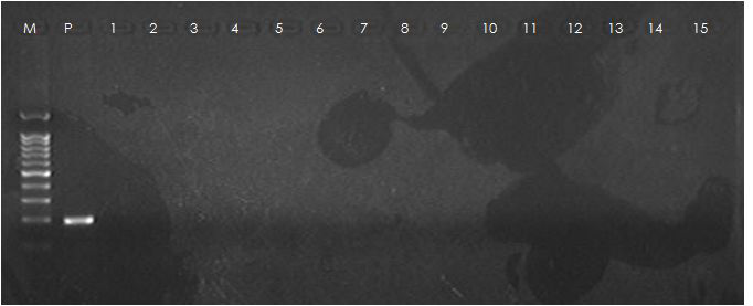 톡소포자충 B1 gene specific primer를 이용하여 nested-PCR을 시행한 결과.