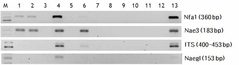 PCR products of N. fowleri DNAs amplified by four kinds of primers after practicing various DNA extraction methods.