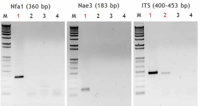 PCR products of various amplified amoebic DNAs in order to observe the species-specificity of three kinds of primers (Nfa1, Nae3 and ITS).