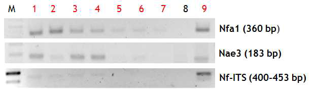 PCR products of various amplified amoebic DNAs in order to observe the sensitivity of three kinds of primers (Nfa1, Nae3 and ITS).