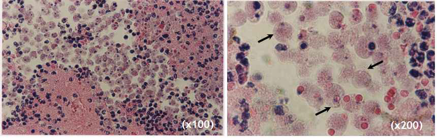 Mouse brain tissue developed PAM due to experimental inoculation of N. fowleri trophozoites (5x105). Numerous amoebic trophozoites were seen (arrows).