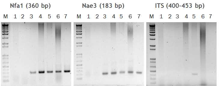 PCR products of N. fowleri DNAs amplified from PAM-mouse brain tissue three kinds of primers, Nfa1, Nae3 and ITS primer.