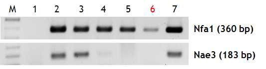 PCR products of various DNAs extracted from PAM-mice brain tissue on day 7 post infection in order to observe the sensitivity of two kinds of primers (Nfa1 and Nae3).