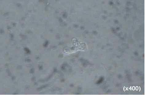 Detecton of N. fowleri trophozoite from PAM-mouse CSF by the in vitro cultivation.