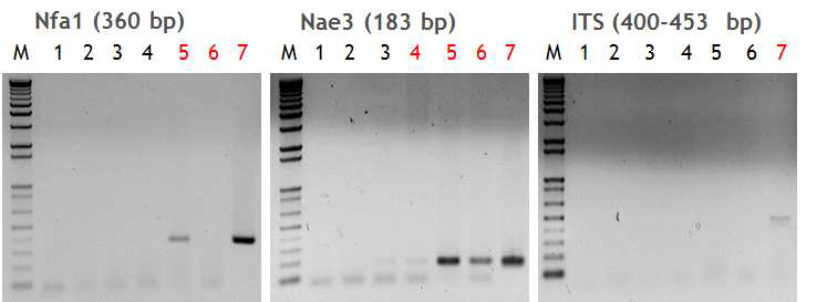 PCR products of N. fowleri DNAs amplified from PAM-mouse CSF by three kinds of primers (Nfa1, Nae3 and ITS). Two PAM-mice CSFs (3 ㎕) on day 3 (lane 2 and 3) post infection were directly used as each template for PCR.