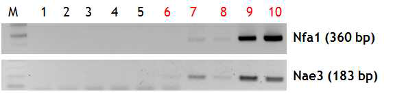PCR products of N. fowleri DNAs amplified from PAM-mouse CSF by two kinds of primers (Nfa1 and Nae3) during the infection period.
