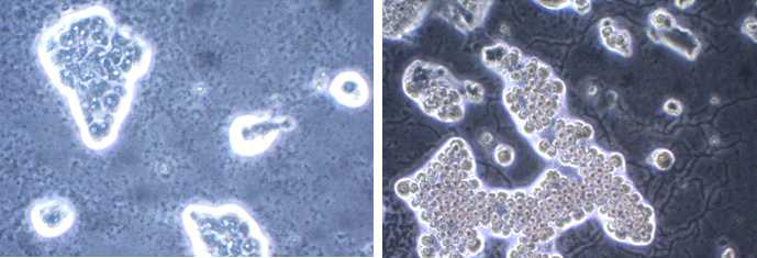 Subcultivation of free-living amoebae on a mon-nutrient agar medium.