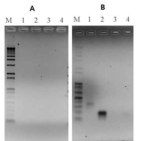 PCR products of N. fowleri DNAs amplified by four kinds of primers after practicing various DNA extraction methods.