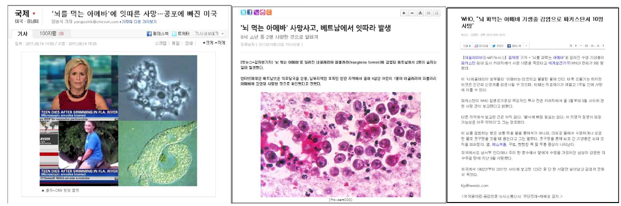 최근 아메바성 수막뇌염으로 사망한 환자들을 보고한 외신 보도 및 국내 보도자료