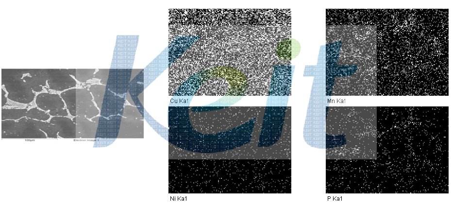 15T 말기 인출부 Image analysis